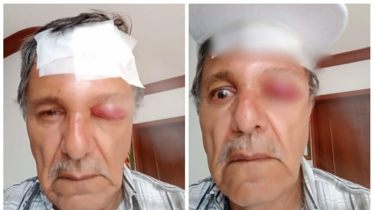 De esta manera, un camarógrafo atacado por un motociclista en Cali

 – Ojo critico