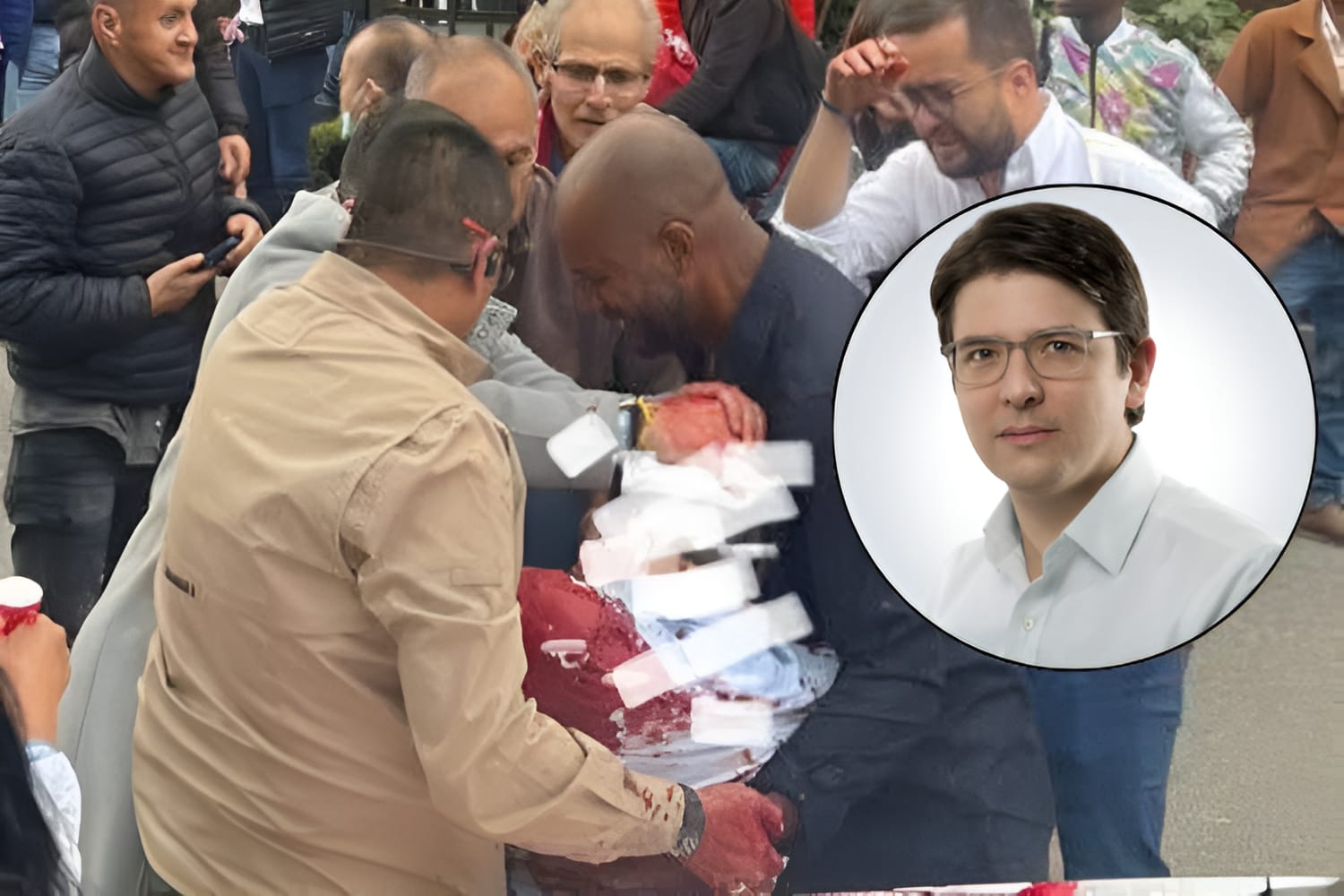 Ataque contra Miguel Uribe Turbay: un año de 15 años le habría disparado al menos seis ocasiones

 – Ojo critico