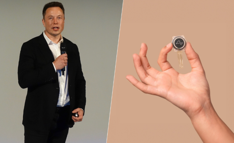 Elon Musk comienza la primera prueba pública de Neuralink en humanos

 – Ojo critico