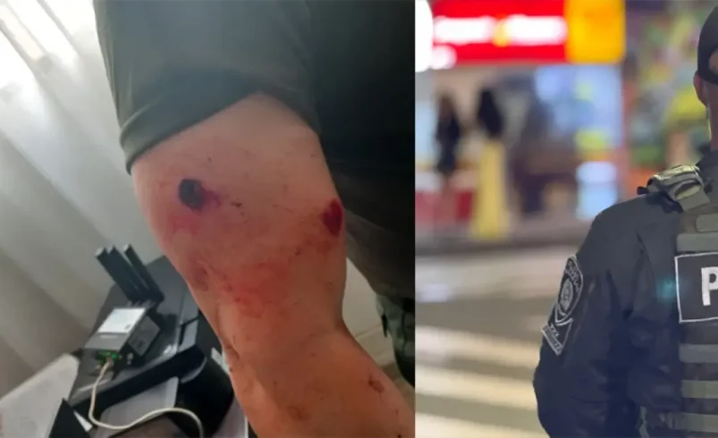 El comandante operativo de la policía de Antioquia resultó herido en el asignado

 – Ojo critico