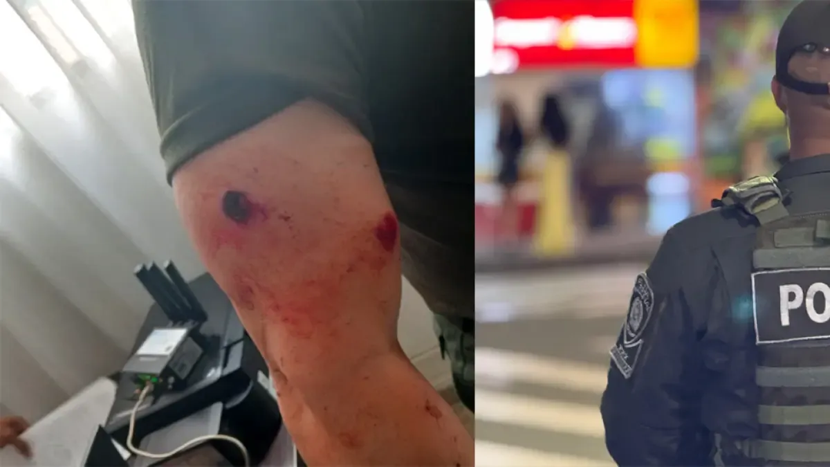 El comandante operativo de la policía de Antioquia resultó herido en el asignado
 – Ojo critico