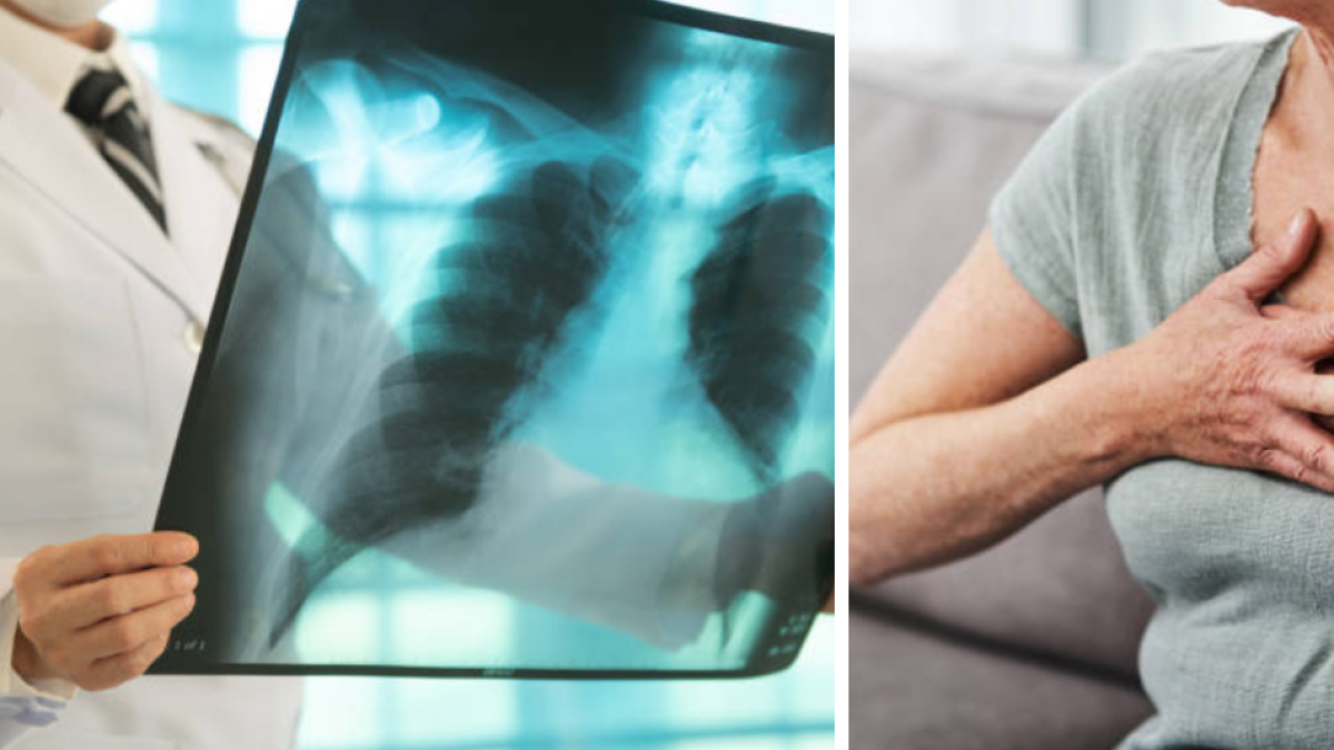 Dadis informa más de 300 casos de tuberculosis hasta 2025.
 – Ojo critico