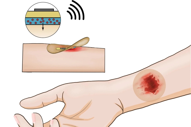 La estimulación eléctrica acelera la curación de heridas, muestra el examen
 – Ojo critico