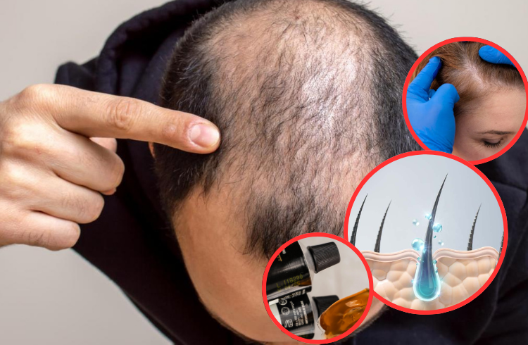 Según un estudio científico, el nuevo gel estimula el crecimiento del cabello hasta en un 90%
 – Ojo critico