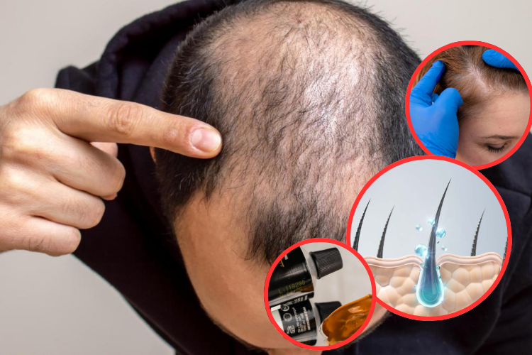 Según un estudio científico, el nuevo gel estimula el crecimiento del cabello hasta en un 90%
 – Ojo critico