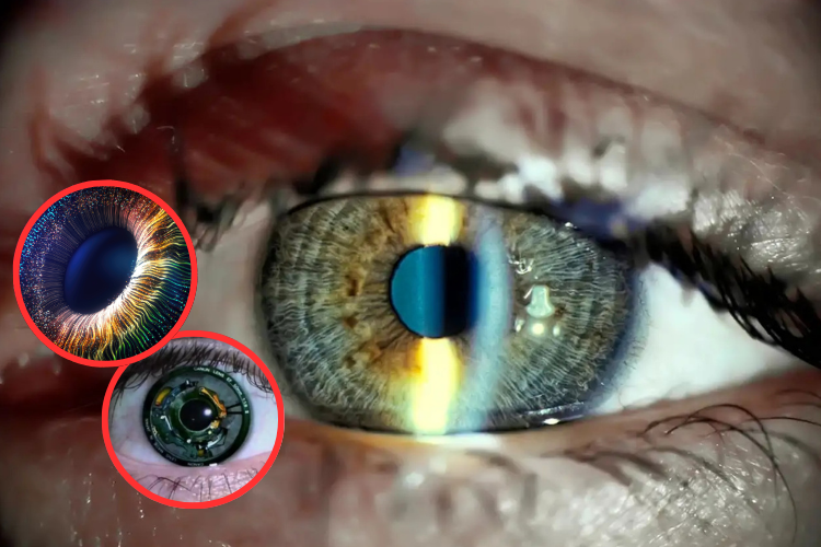 Un revolucionario implante ocular devuelve la vista a los ciegos
 – Ojo critico