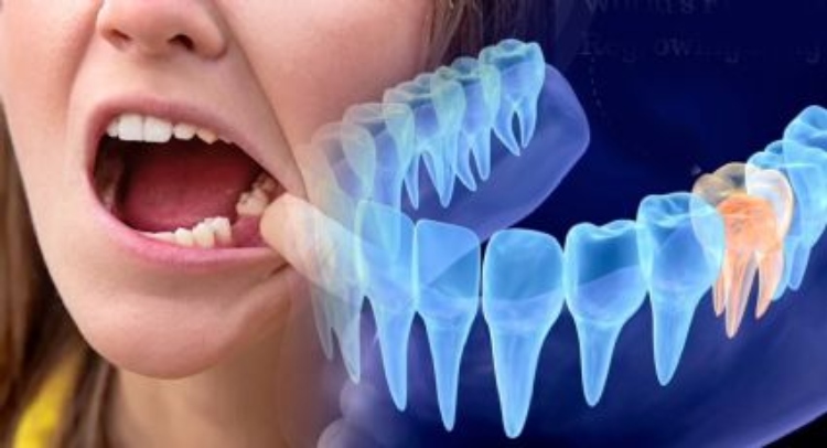 Los científicos en Japón descubren células madre que forman raíces dientes
 – Ojo critico