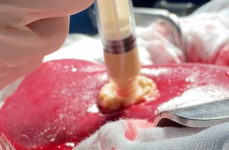 Los jóvenes crean ángeles de algas que deja de sangrar

 – Ojo critico