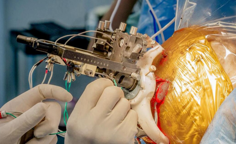 Innovador experimento médico en América Latina: implantación simultánea de chips en el cerebro para aliviar síntomas de la enfermedad de Parkinson

 – Ojo critico