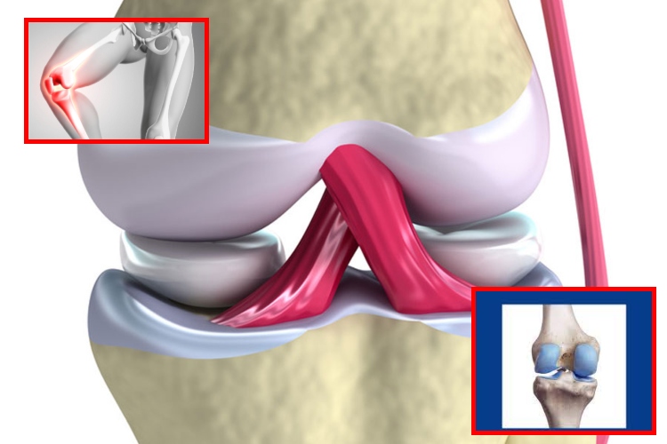 Cartílago artificial que imita la flexibilidad humana

 – Ojo critico