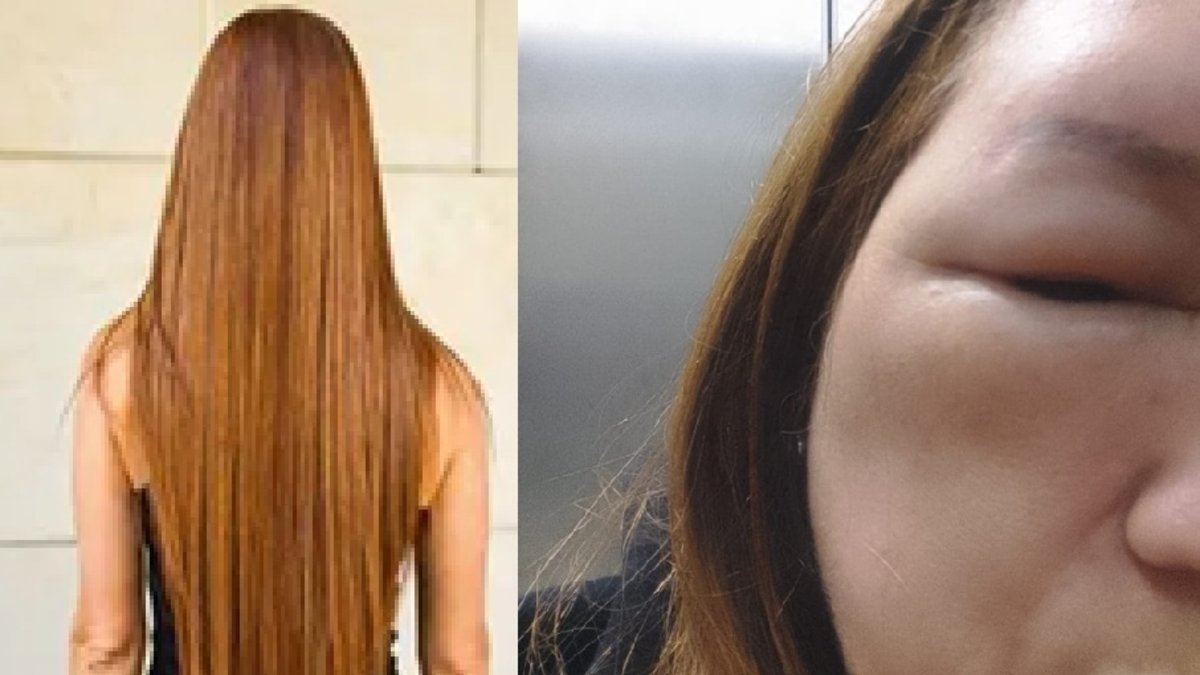 su cráneo y su cara estaban hinchados

 – Ojo critico