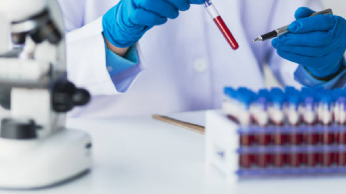 hospitales importantes de la región no tienen 0+ y 0 –

 – Ojo critico