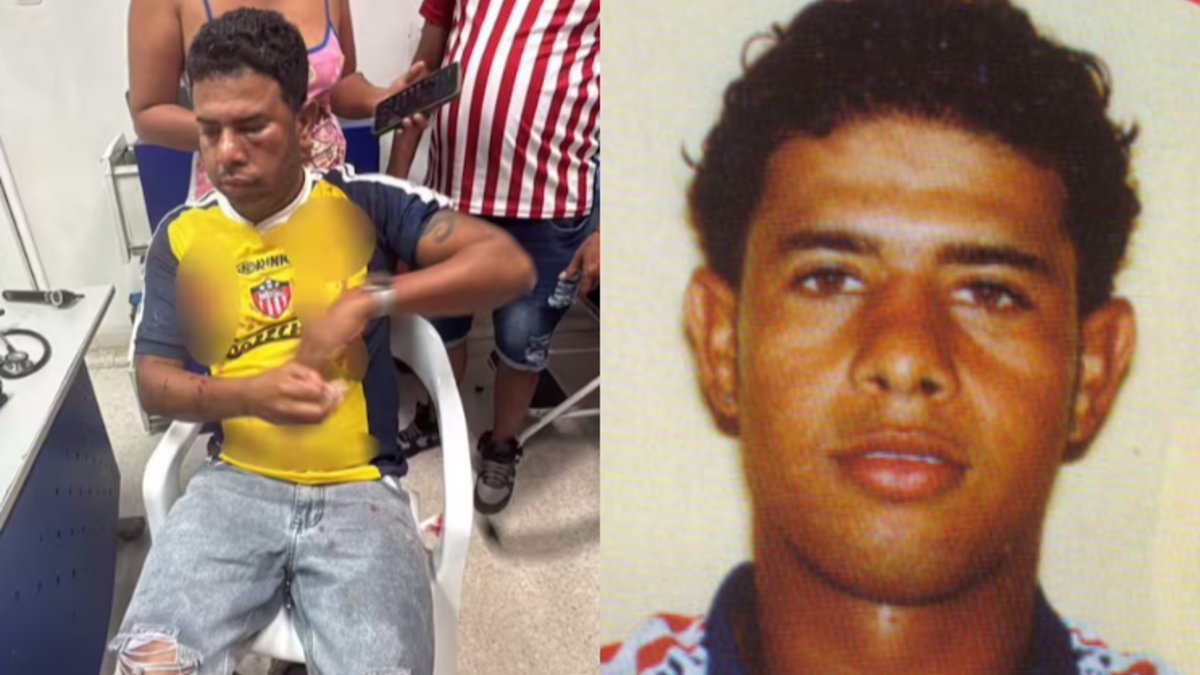 Daniel Machacón, exjugador junior, se recupera de una lesión durante una trifulca en Suan

 – Ojo critico