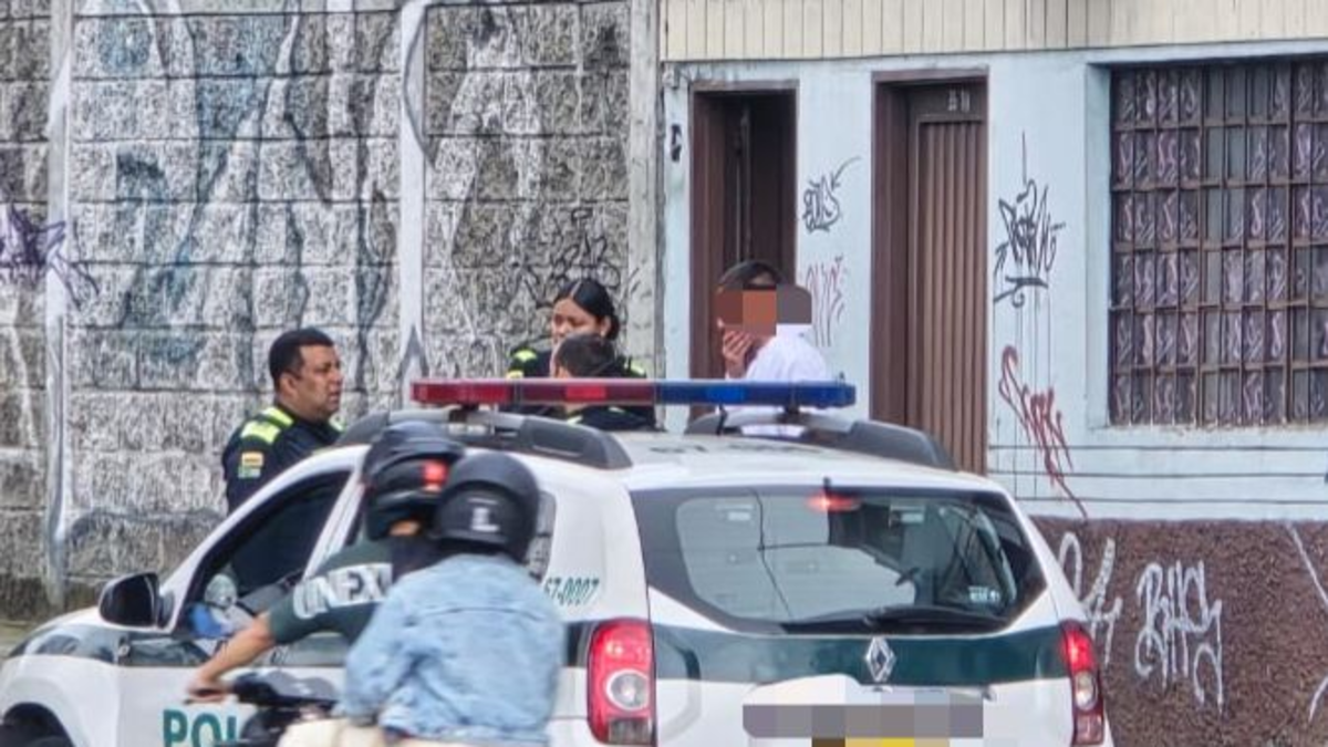 tiene quemaduras de segundo grado

 – Ojo critico