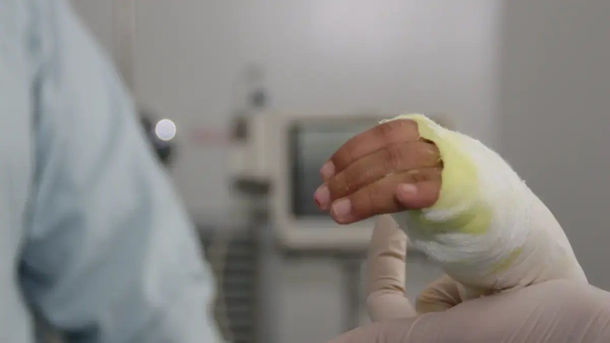 Un menor de ocho años se encuentra en la UCI debido a graves quemaduras por gasolina recibida en su cuerpo.

 – Ojo critico