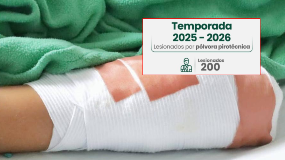 Antioquia llegó a 200 quemados por pólvora: esta es la mayor cifra de heridos en el departamento en la última década: Medellín registra 79 casos

 – Ojo critico