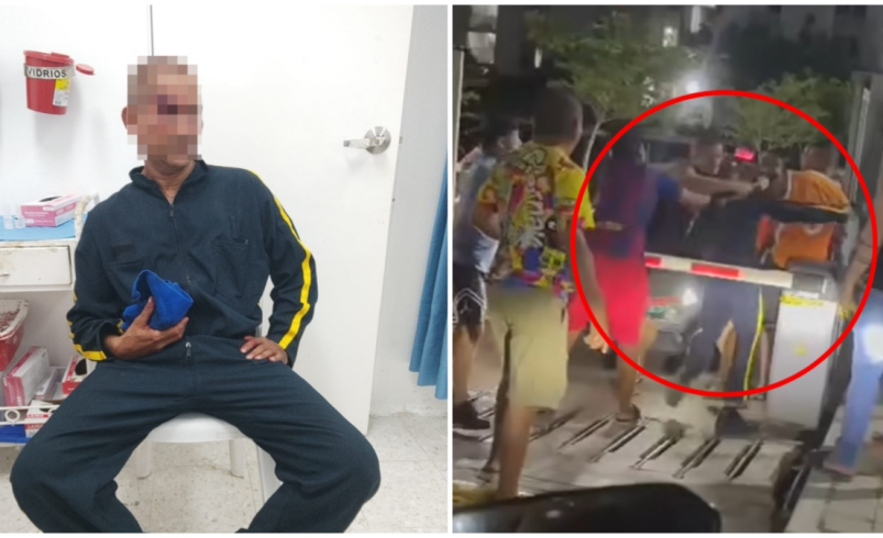 «Fue brutalmente atacado»

 – Ojo critico