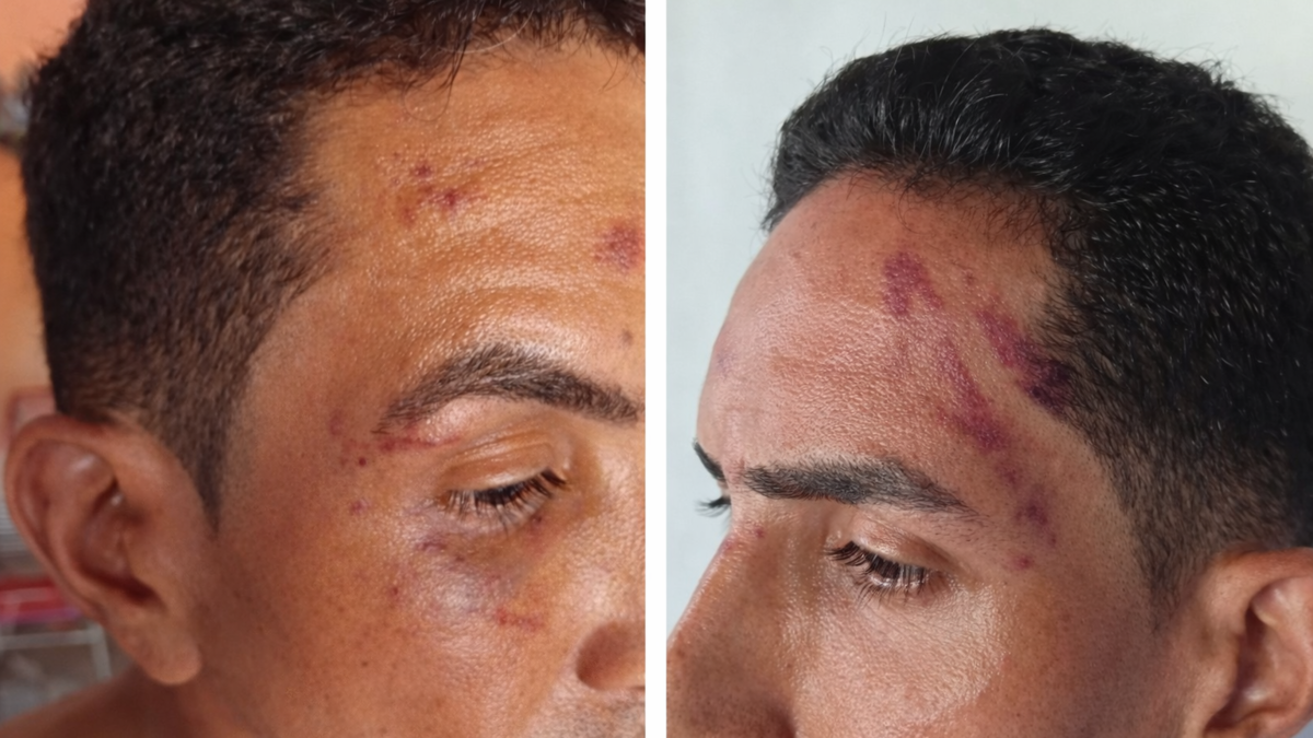 un artesano fue víctima de turistas colombianos que lo golpearon en el centro histórico de Cartagena; ¿por qué lo atacaron?

 – Ojo critico