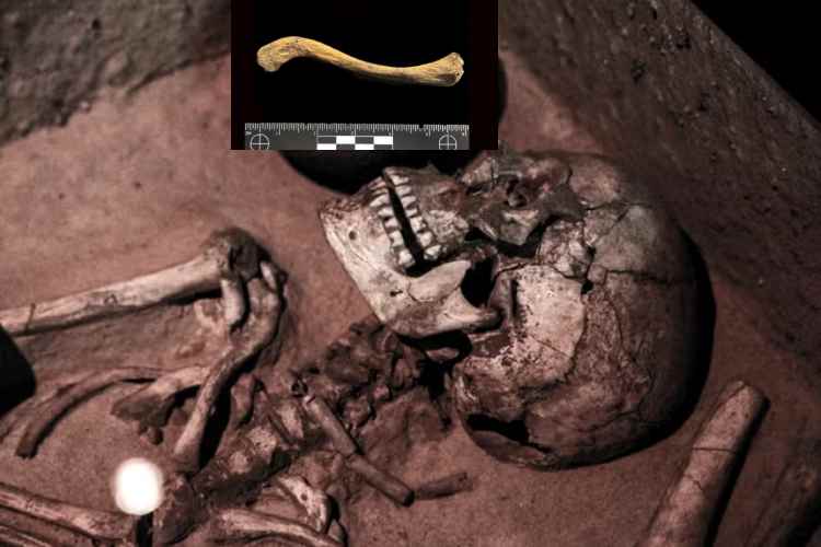 Descubren en Colombia la sífilis más antigua del mundo

 – Ojo critico