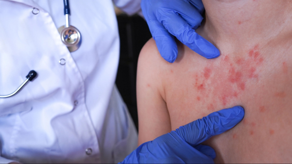 El gobierno pide actualizar programas de vacunación para casos importados en Bogotá y Bucaramanga

 – Ojo critico