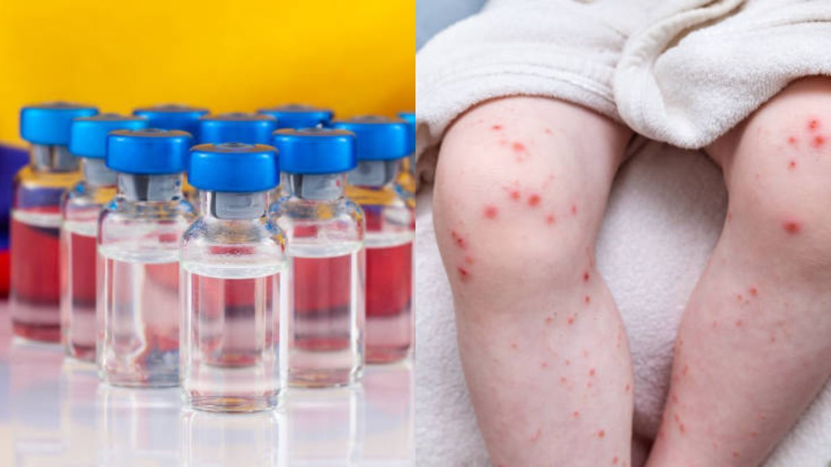 La Secretaría Regional de Salud espera respuesta del Gobierno al pedido de 20.000 dosis

 – Ojo critico