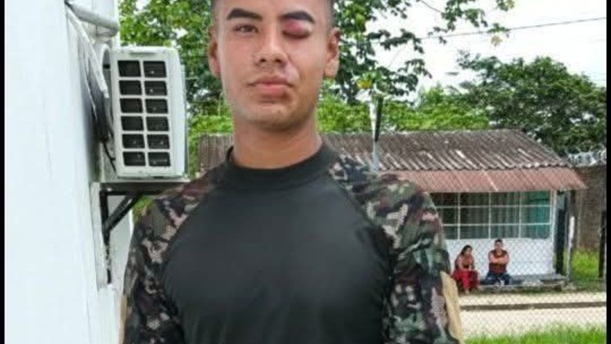 un desgarrador testimonio de uno de los 57 sobrevivientes del accidente del Hércules en Putumayo

 – Ojo critico